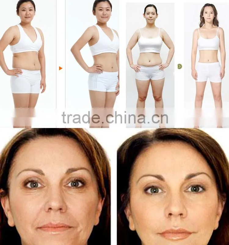 cryo Slimming machine cryo strong vacuum device body shaping