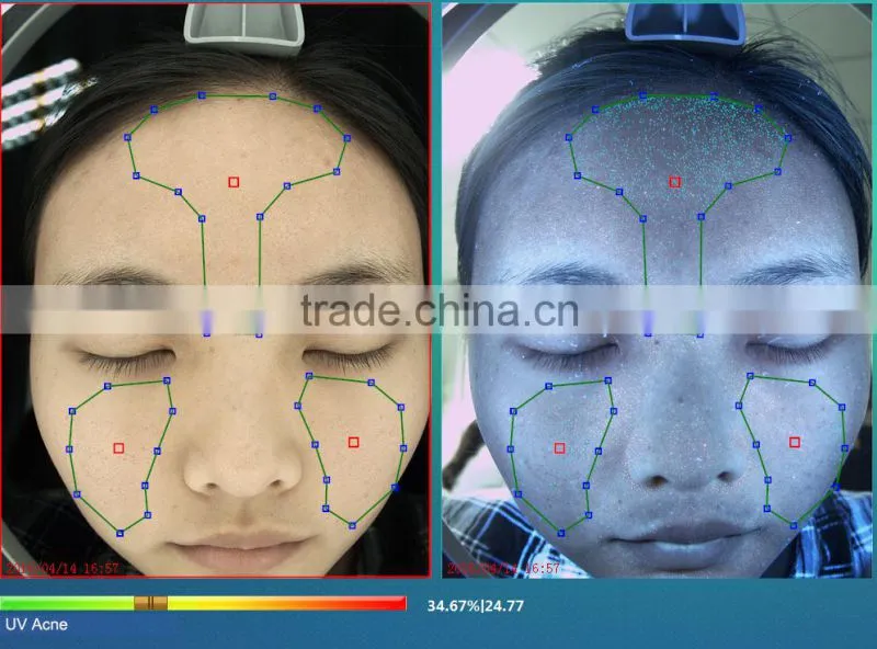 2016 Newest Portable Skin analysis machine Skin analyzer with CE