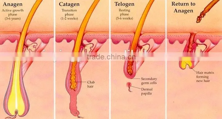 CE Certification and Yes IPL+ RF OPT SHR hair removal machine