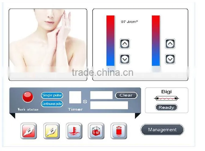 New Arrival 2 handles IPL+RF E-Light Treatment printing system ipl rf shr laser equipment e light ipl rf