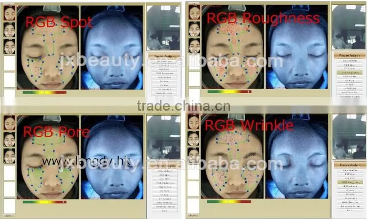 Portable skin analyzer skin scanner