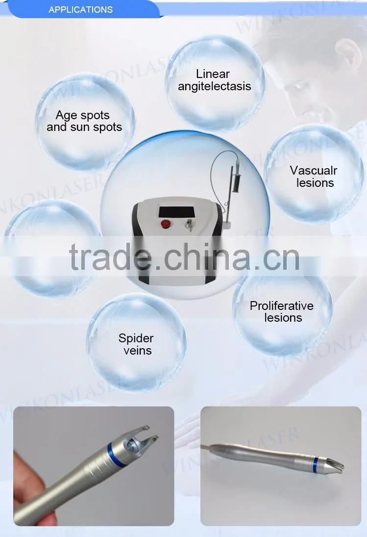 Wholesale OEM ODM approved leg legs care varicose spider vein treatment cream natural method