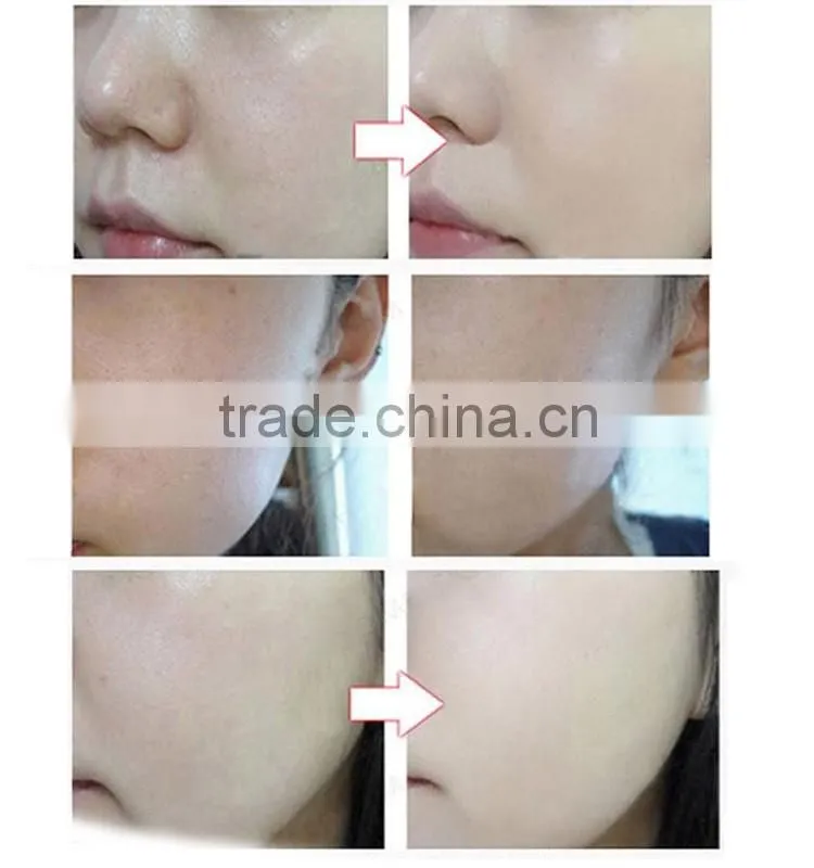 Health Beauty Skin Rejuvenation led light therapy mask