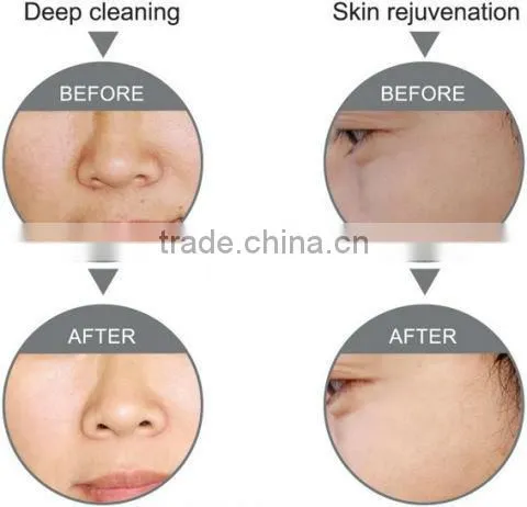 2015 NEW Oxygen Jet Peel & Water Oxygen Beauty Equipment o2 machine Guangzhou SPA