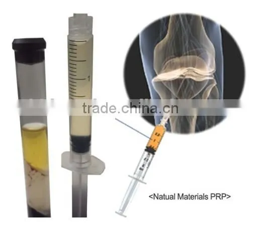 Pyrogen free ACD additive PRP tube for platelet rich plasma treatment