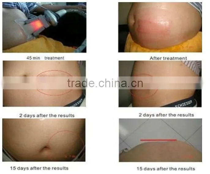 China 5 handles body slimming massage beauty equipment for sale