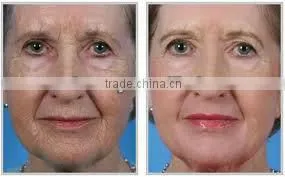 Skin cleaning device electric Facial cleansing Brush