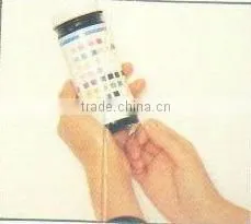 Urine Control Urine Analysis System YH-1520A