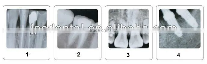 Digital portable dental X-Ray AP-60P