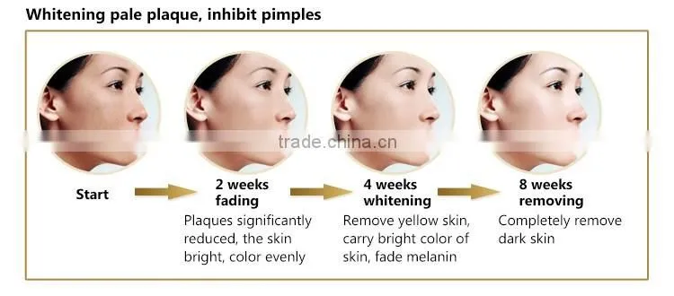 Best RF Lattice Skin Tightening Face Lifting Machine for Home Use