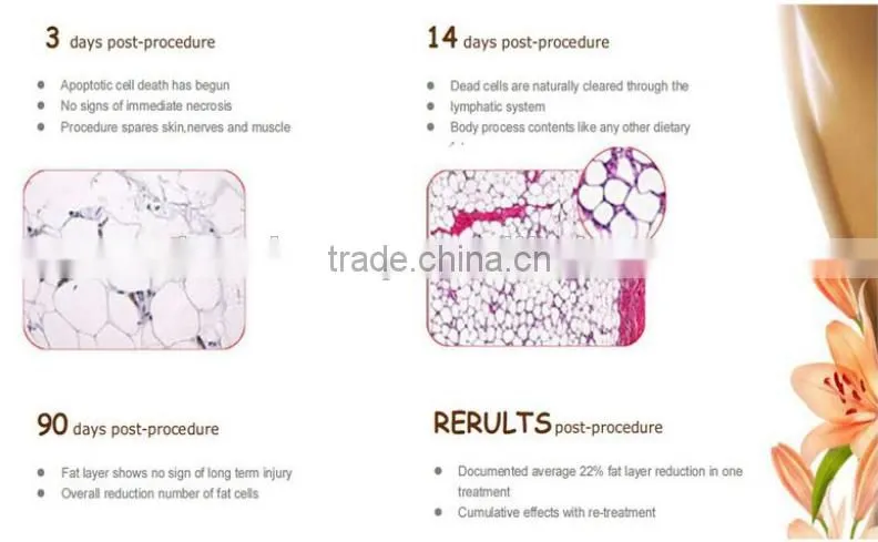 portable weight loss criolipolysis fat freezing beauty machine price