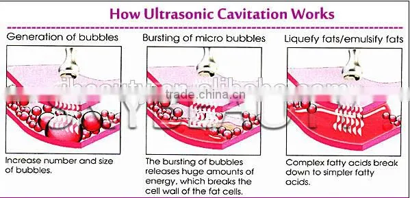 Fat Cavitation Device For Home/Weight Loss Machine