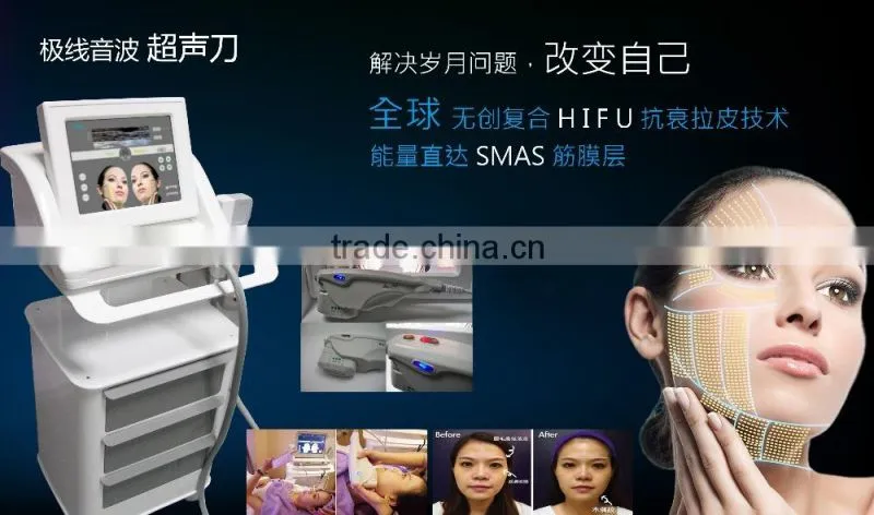 2015 Wholesale Nice looking e light beauty equipment