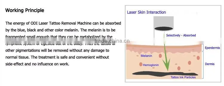 Beauty & Personal Care nd yag q switch laser for spot removal and frekle removal with CE