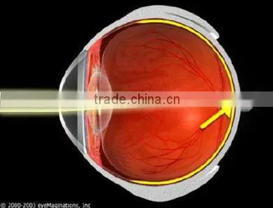 For Myopia with high intraocular pressure High-end MCT Technology