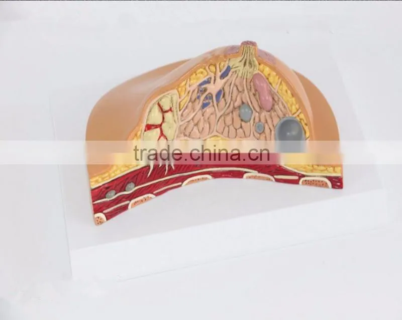 Medical breast disease model breast anatomical model medical training model breast feeding model
