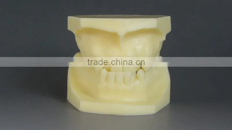 Malocclusion Classification Demonstration Model 2