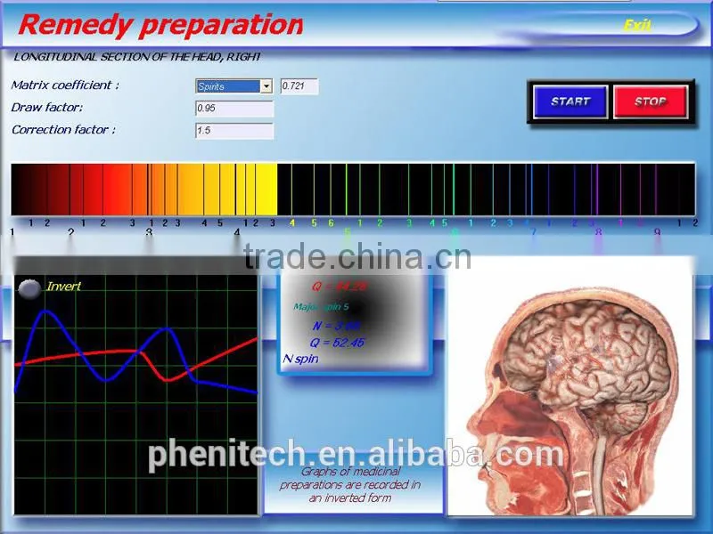 2015 latest version 3dnls quantum body health analyzer