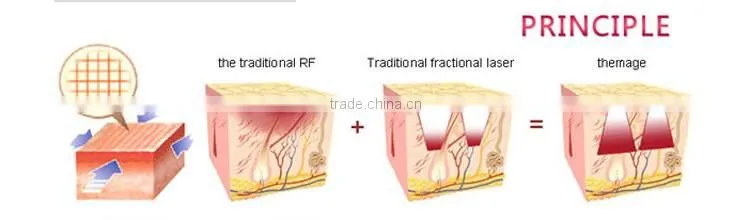 Portable Skin Tightening microwave frequency