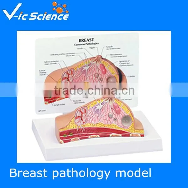 High Quality Chinese Model Of Acupuncture With Musucle