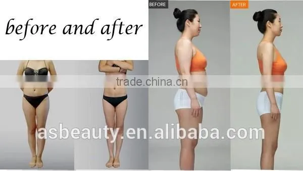 RF cavitation cryo lipo laser slimming instrument