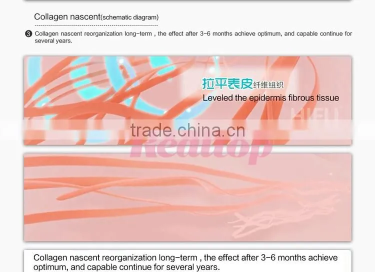 best at home beauty devices portable hifu machine face lift hifu beauty machine