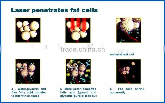 non-invasive lipo cavitation fat+diode lipo for fast slimming