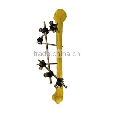 CE approved 3 rods and 4 screws fixator with low price