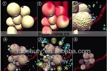 Inner Roller best alternative to liposuction