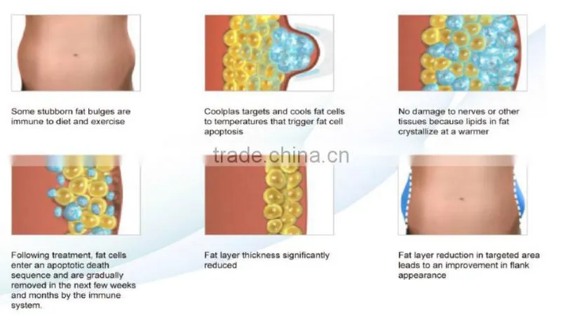 Coolplas Cryo Lipolisis Advanced Medical anti cellulite Beauty device
