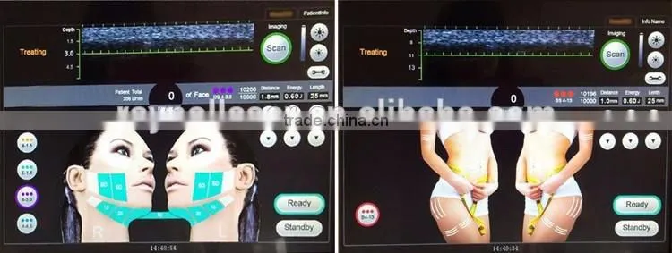 Raynol 2016 eShape-III 5 Transducers HIFU Face and Body Machine