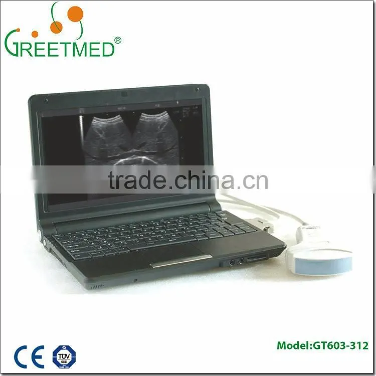High quality new design cheap ultrasound machine