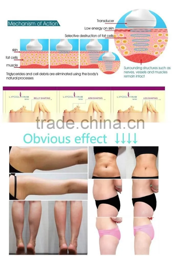 AYJ-S12B CE portable hifu slimming machine/liposonix slimming equipment