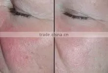 Hot Korea new product led mask 7 colors led skin rejuvenator mask for clinic or salon use