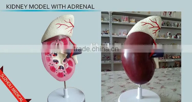 Kidney model with adrenal