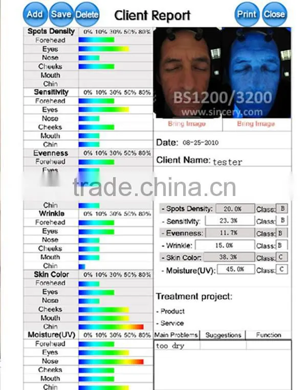 Magic Mirror Skin Analyzer