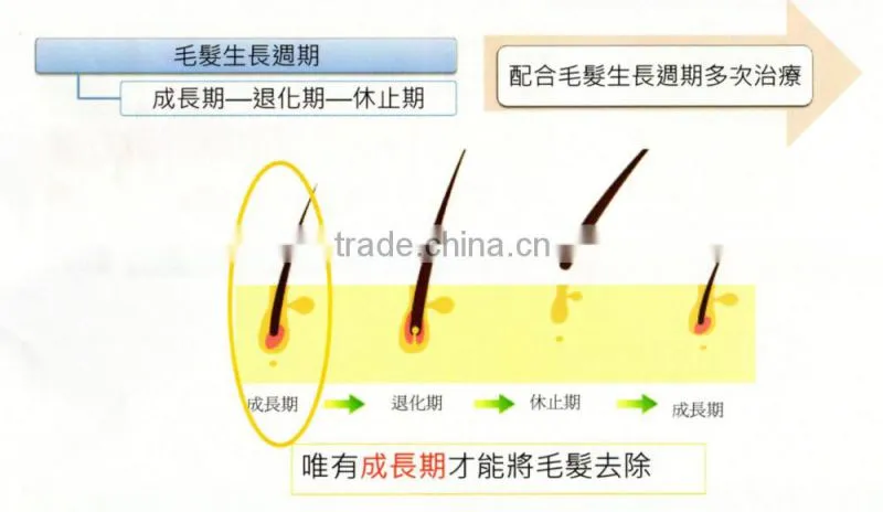 2016 Newest 808nm diode laser permanent hair removal machine