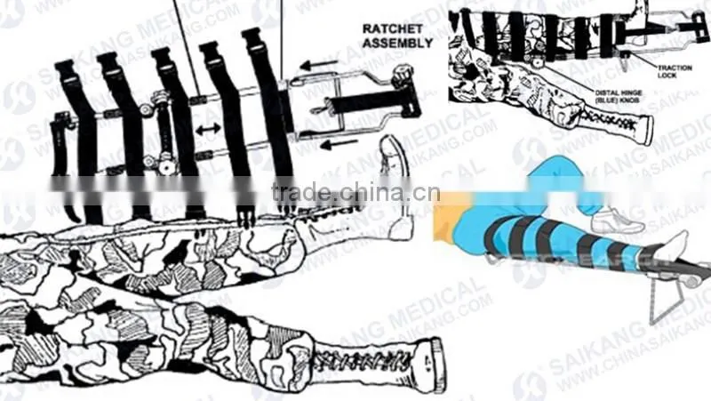 Medical Appliances Leg Traction Splints