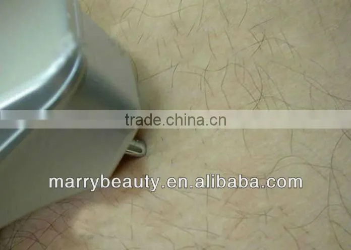 Mini Portable Home Use Laser Hair Removal MB-P289