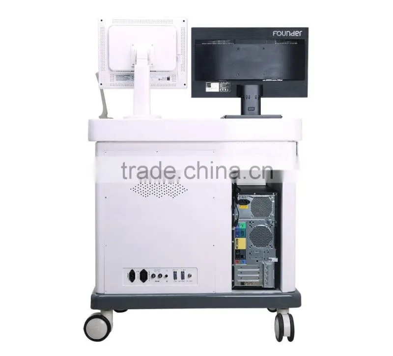 19"LCD ultrasound scanner PRICE With high-end color inkjet printer Display image in real time