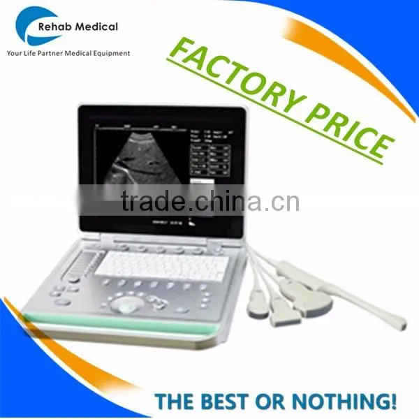 Excellent Portable Wireless Ultrasound Transducers for sale -WBU01