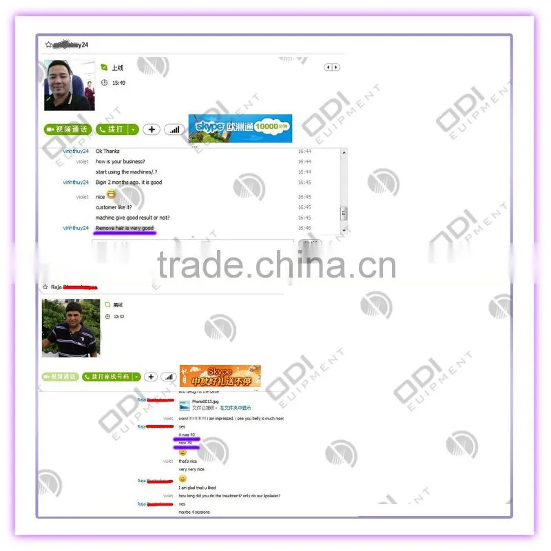 Leading technologies vacuum fat suction machine