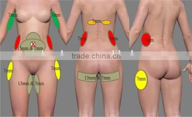 cavitation hifu slim machine / High Quality Hifu