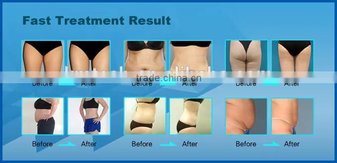 Multifunctional beauty machine made in china