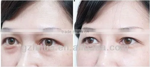 vertical Ultrasonic Slimming Cavitation Machine