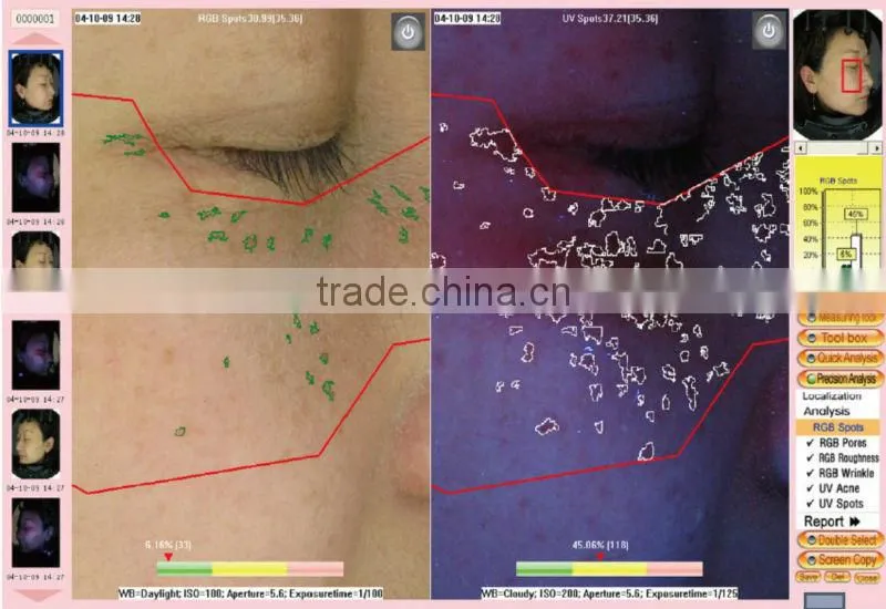 whole face testing skin analyzer magic mirror