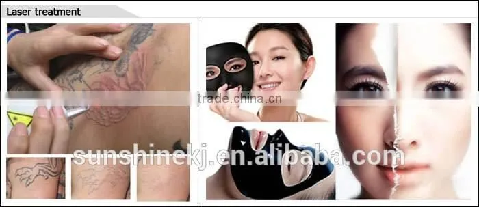 The most cost-effective biggest demand CE approved laser hair removal machines ipl