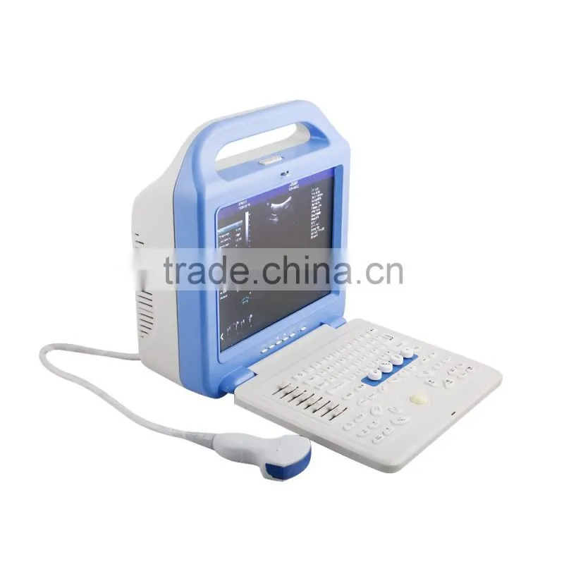 Portable Full Digital Color Doppler Ultrasound Scanner Diagnostic System 2 Probe with convex probe and transvaginal probe