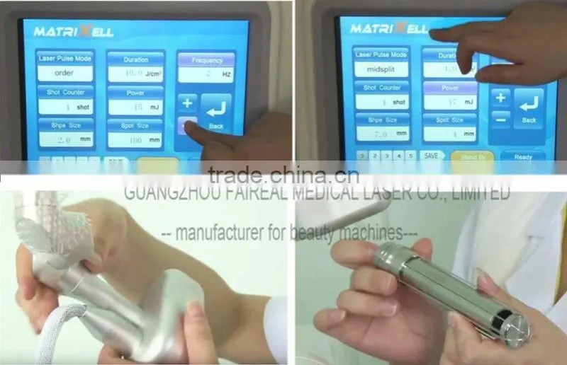 co2 fractional laser vaginal tightening, laser beauty equipment better than vaginal tightening stick
