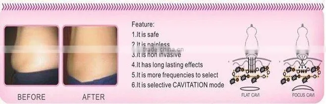 body shaping rf cavitation machine ISO&CE